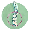 Ankylosing Spondylitis