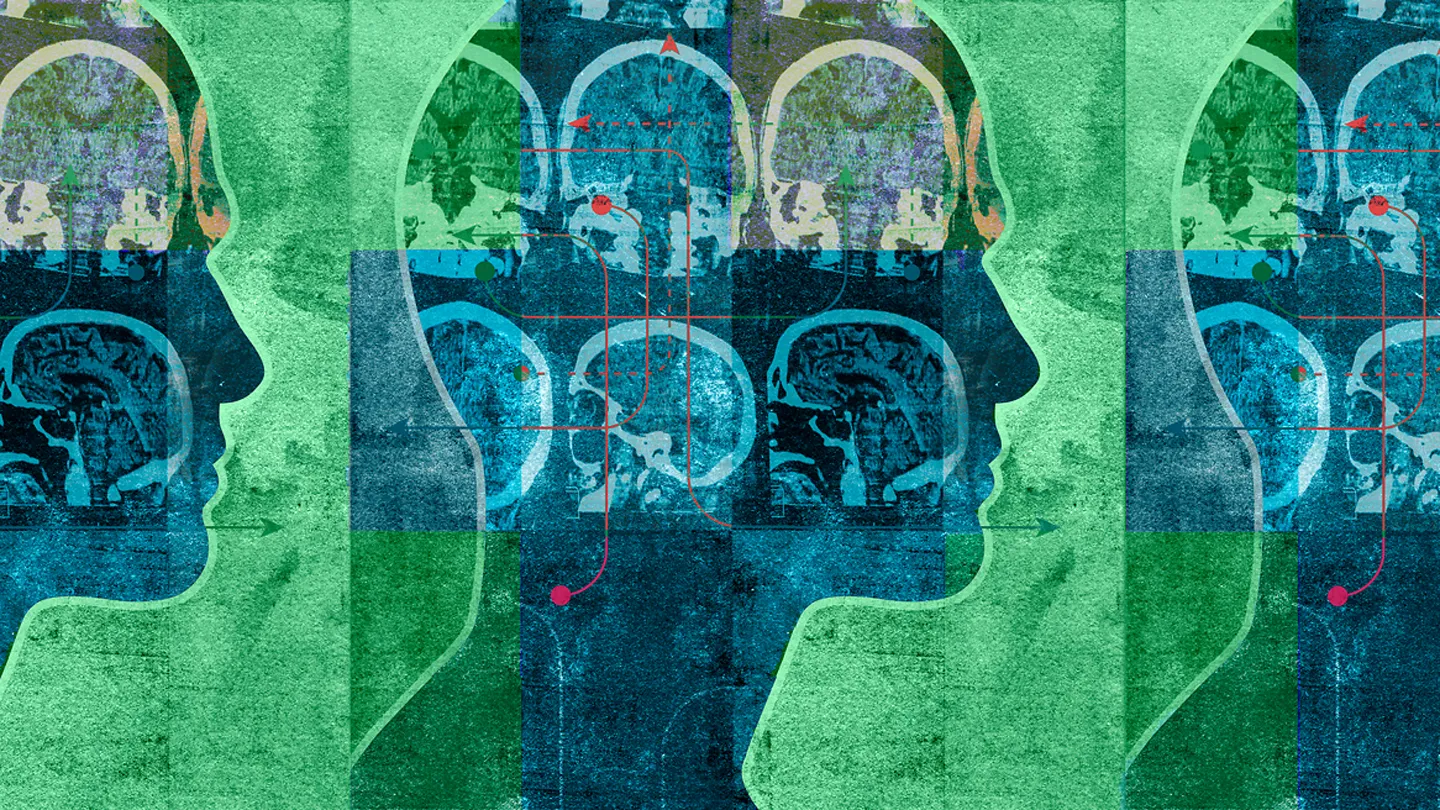 conceptiual illustration of x-rays of human brain