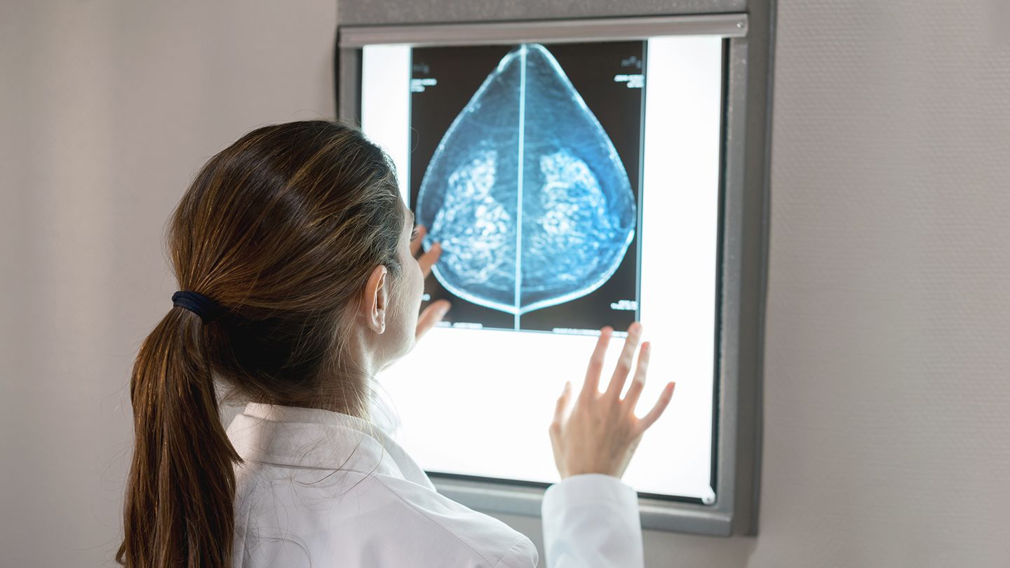 female gynocelogist looking at a patients mammogram results