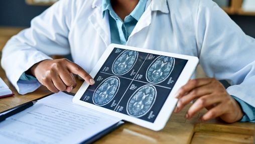 What Is Breast Cancer With Brain Metastasis?