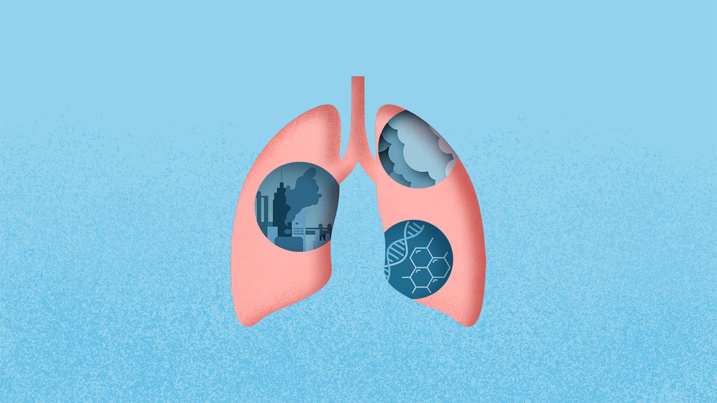 illustration of lungs with three circles inside showing air pollution from factories a cloud of second hand smoke and a dna genetic strand
