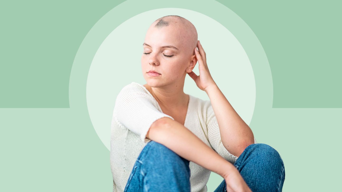 woman with alopecia areata sitting with eyes closed and one hand on head