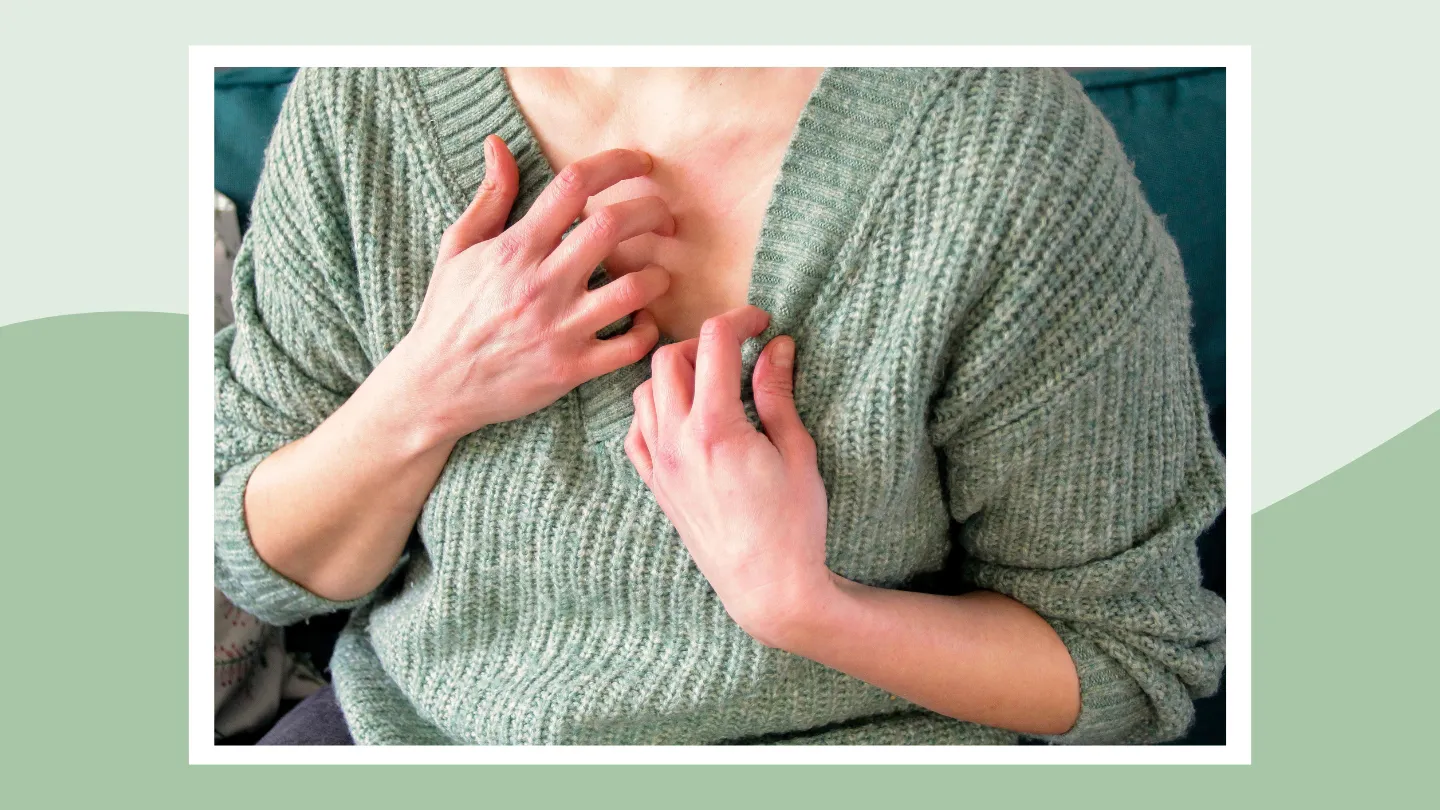 woman scratching her chest because of a rash