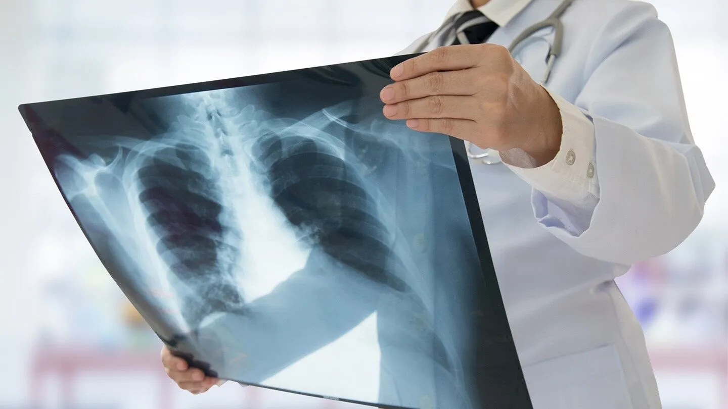 a doctor looking at an xray to check for lung cancer