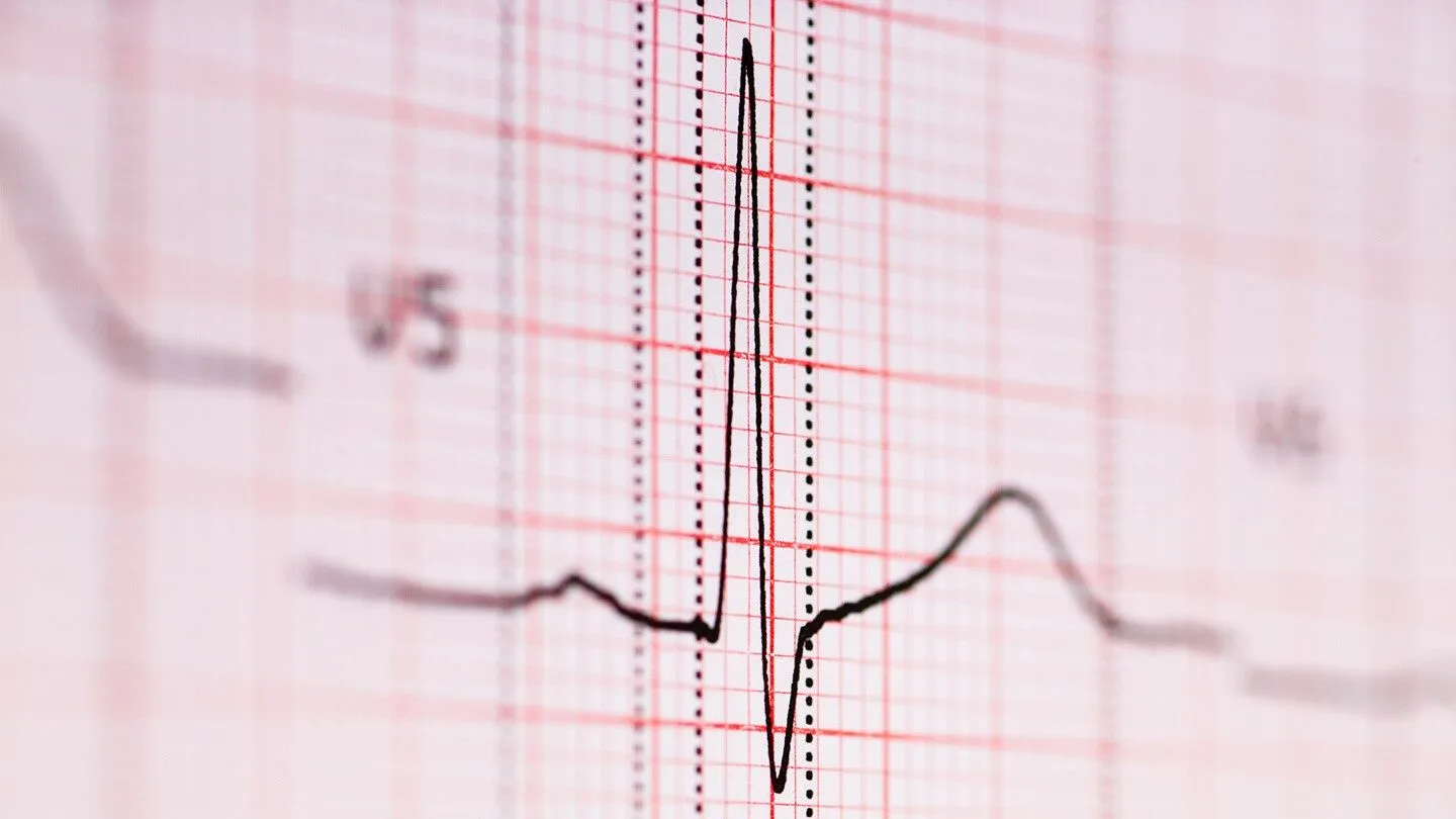 a heart beat, which can represent heart failure