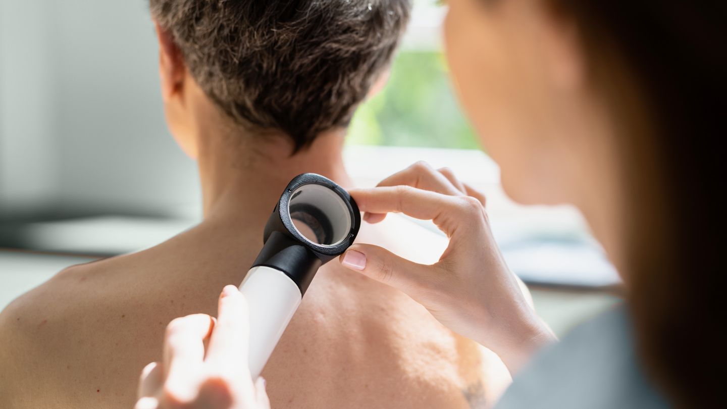 dermatologist looking at male patient's back for skin cancer