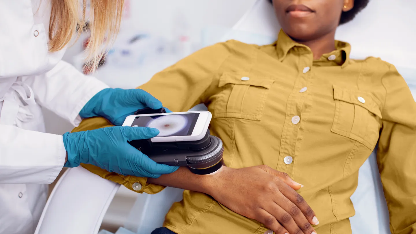 CS-How-to-Get-Better-Treatment-for-Skin-Cancer-as-a-Black-American