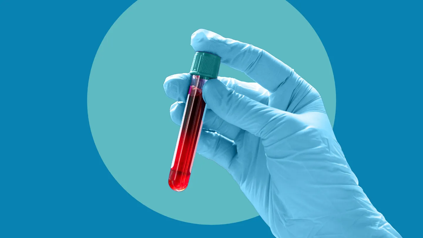 gloved medical professional holding a vial of blood for sceening test