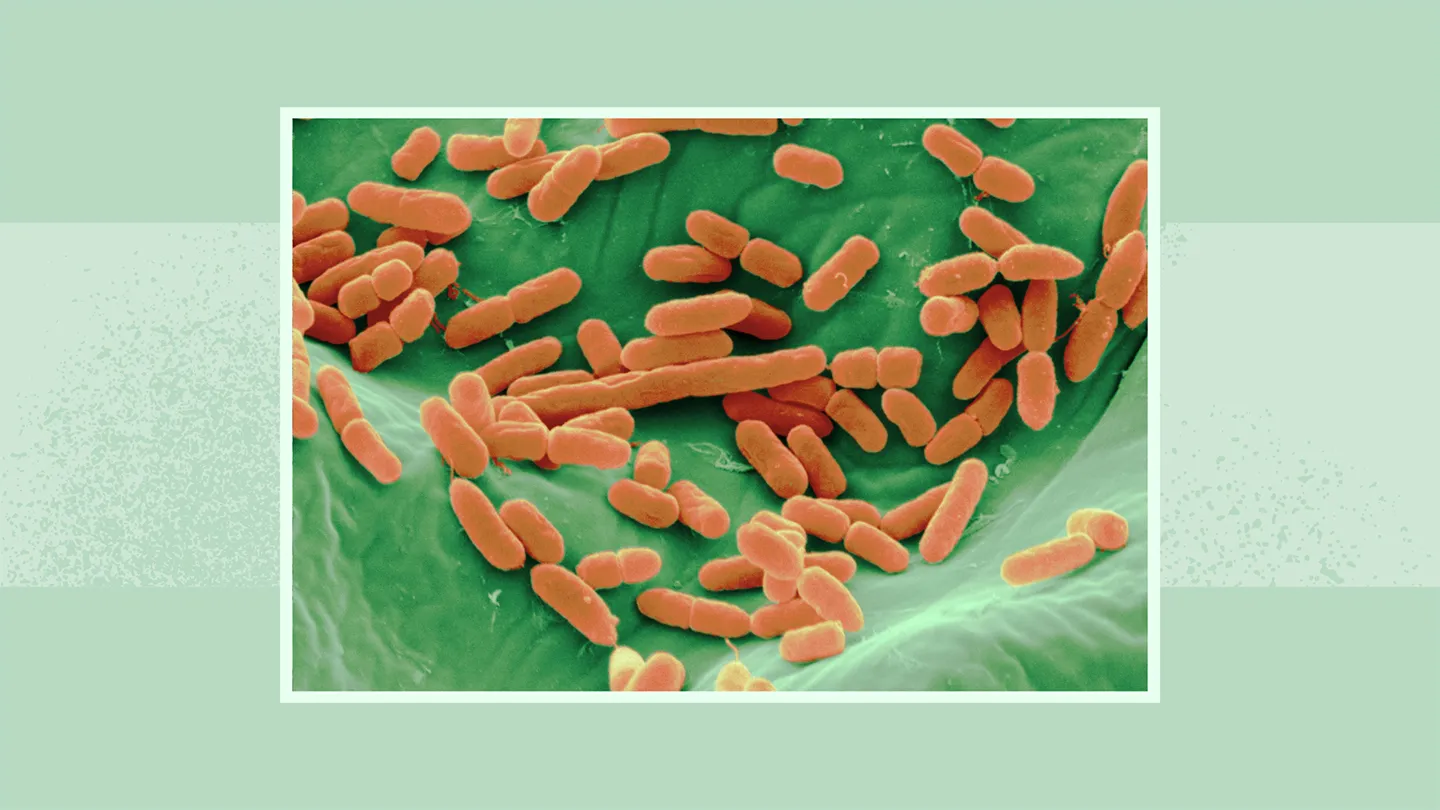 e. coli bacteria
