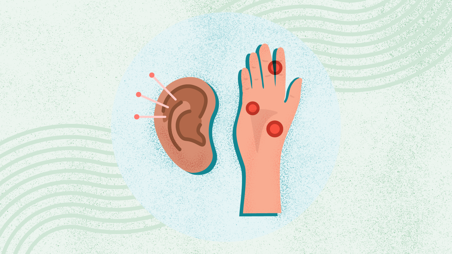 Accupuncture and Acupressure