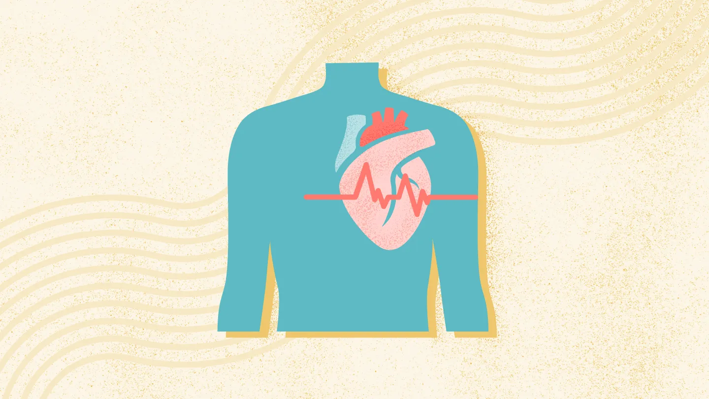 Atrial Fibrillation