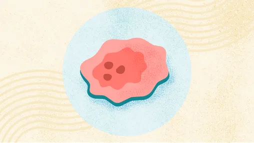Cancer Risks, Signs, Symptoms, Tests, Treatments, and More