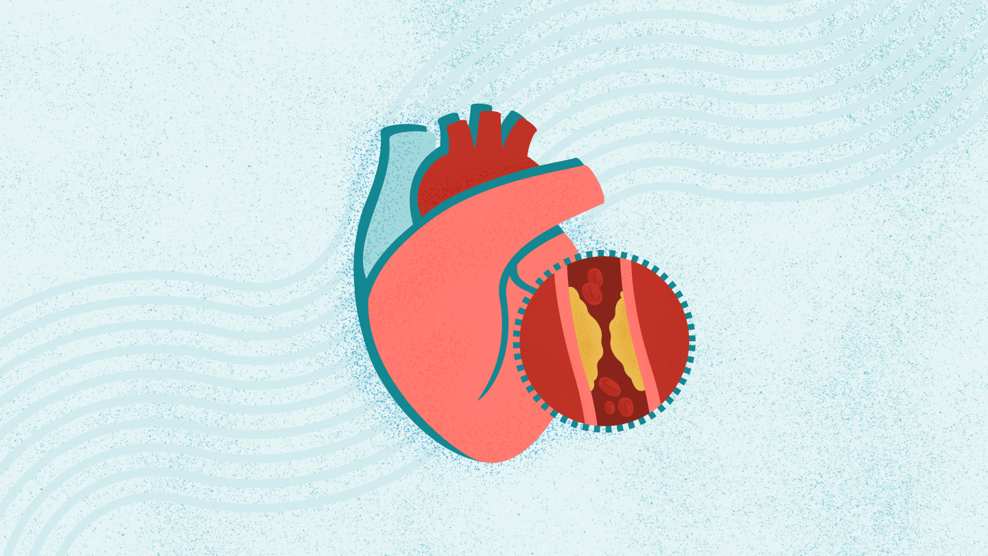 Coronary Heart Disease