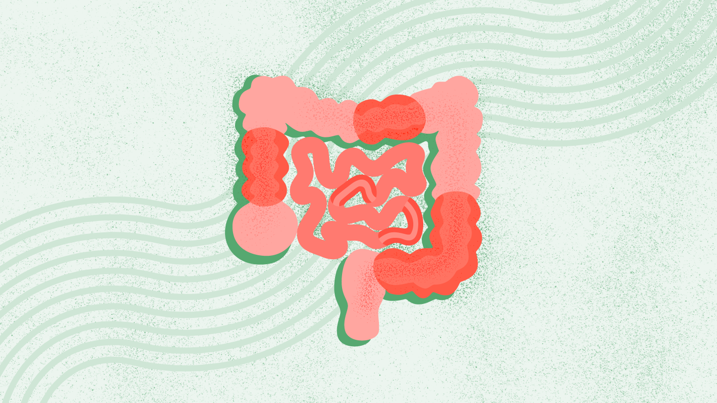 Crohns