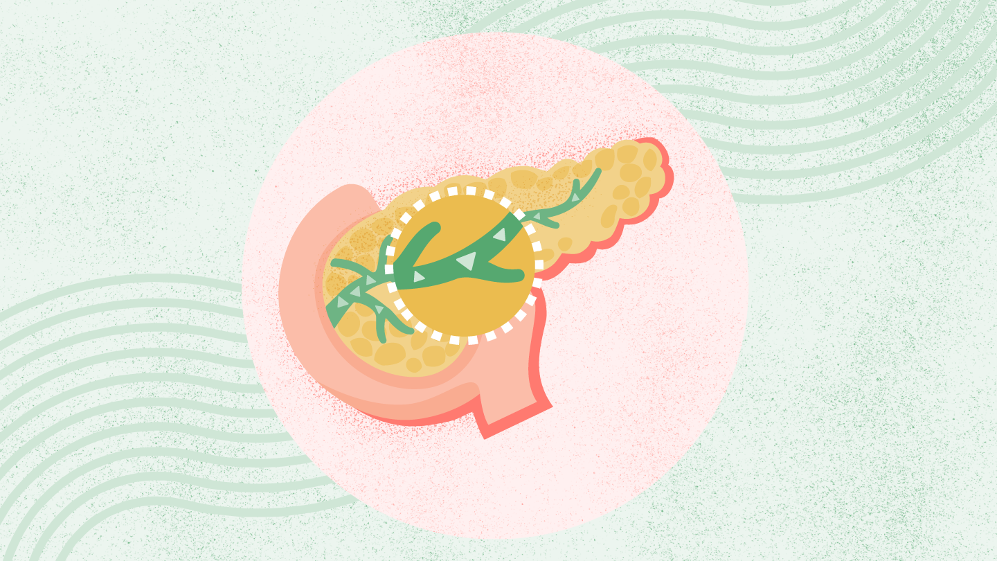 Exocrine Pancreatic Insufficiency