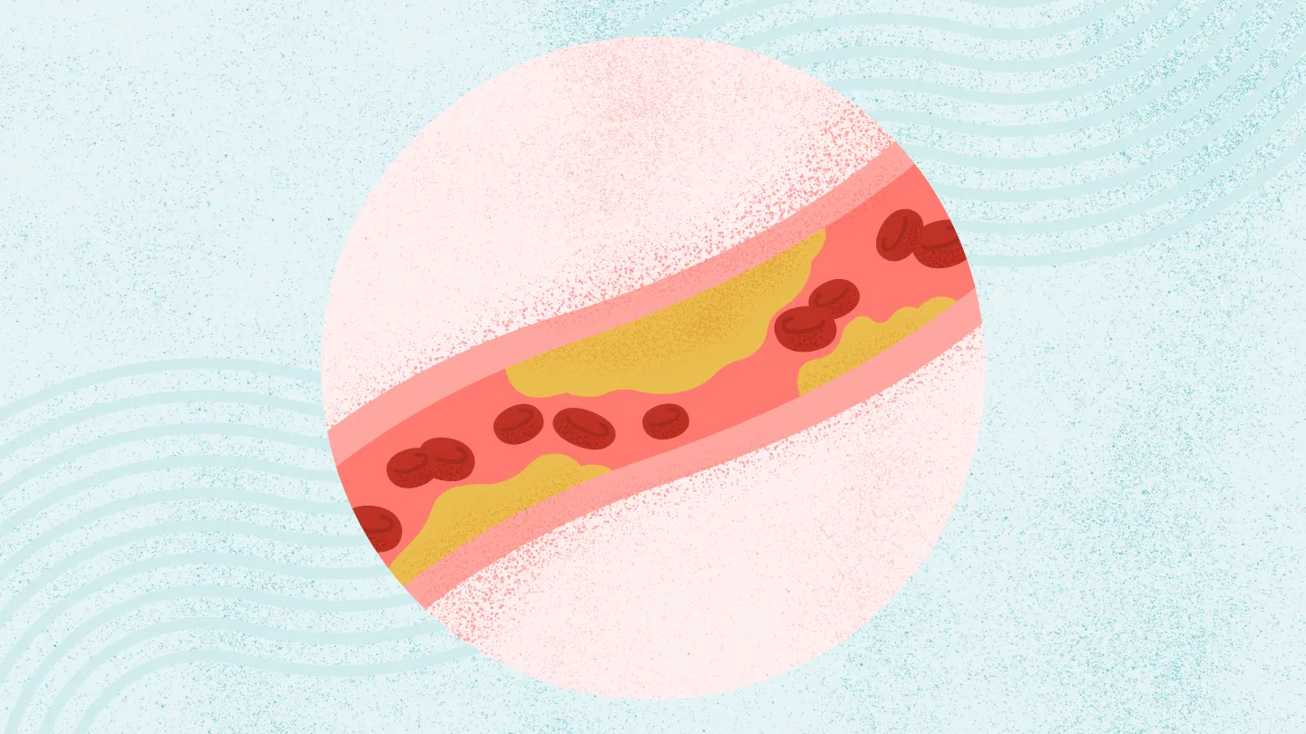 High Cholesterol