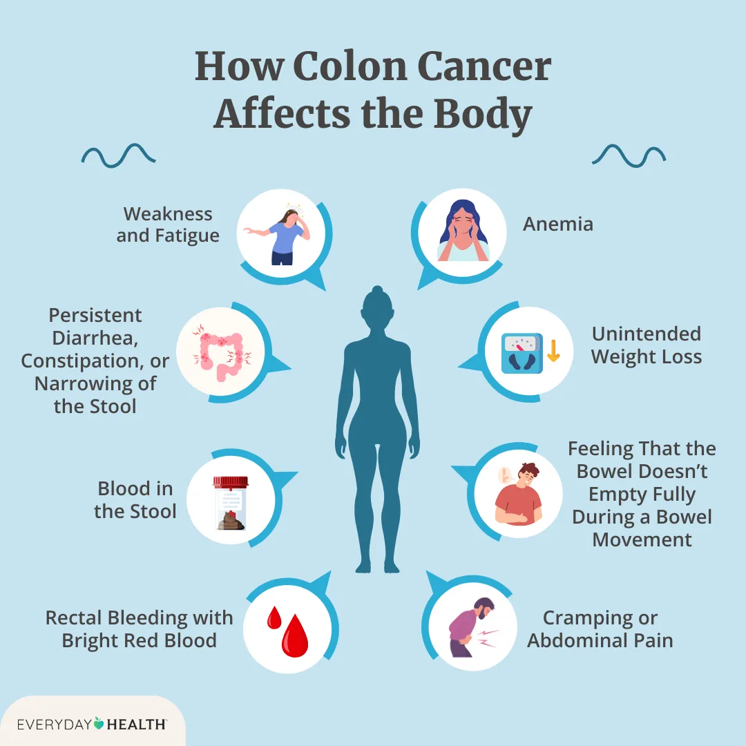 Illustrative graphic titled How Colon Cancer Affects the Body shows weakness, persistent diarrhea, blood in stool, rectal bleeding, cramping, feeling that the bowel doesn't fully empty after you've used the bathroom, unintended weight loss and anemia. EH