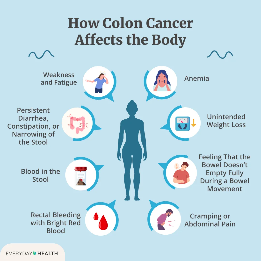 Illustrative graphic titled How Colon Cancer Affects the Body shows fatigue, diarrhea, blood in stool, rectal bleeding, cramping, feeling like the bowl doesn't empty, weight loss and anemia. Everyday Health logo at bottom left