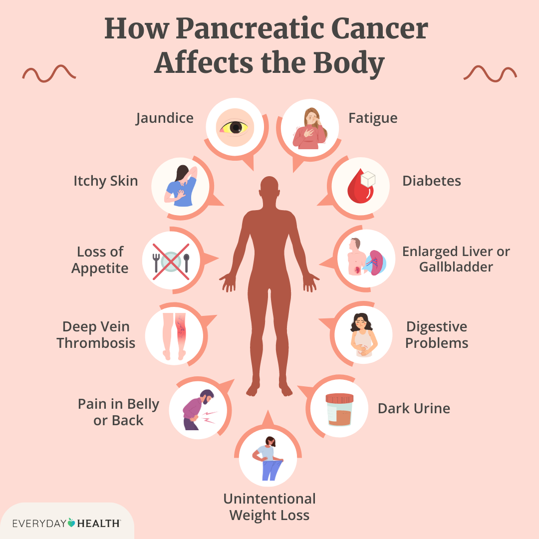 Illustrative graphic titled How Pancreatic Cancer Affects the Body shows jaundice, itchy skin, no appetite, vein thrombosis, belly pain, weight loss, dark urine, digestive issues, enlarged liver, diabetes and fatigue. Everyday Health logo at bottom left