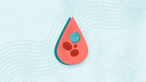 What Is Leukemia? Symptoms, Causes, Diagnosis, and Treatment
