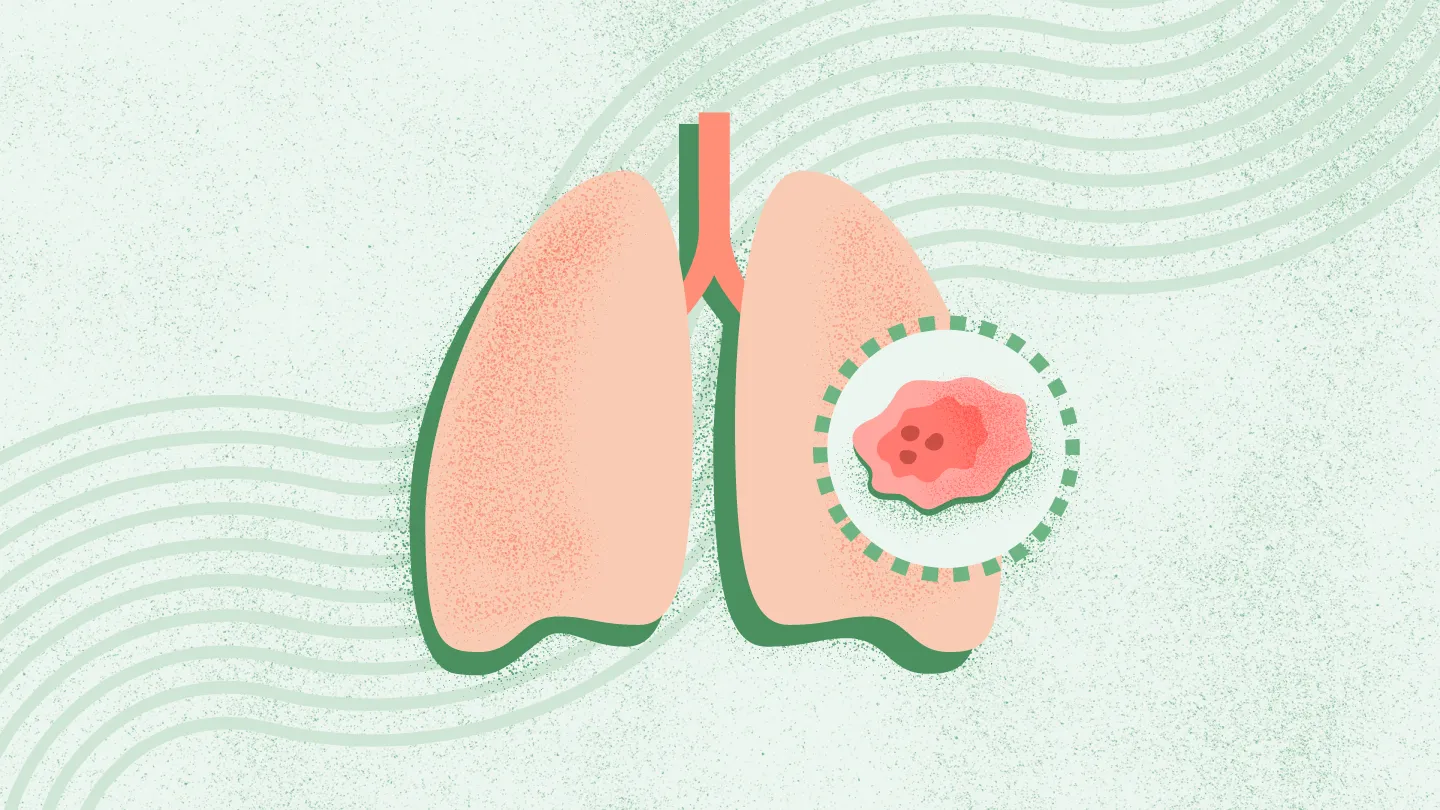 Lung Cancer