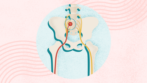 What Is Sciatica? Symptoms, Causes, Diagnosis, Treatment, and Prevention