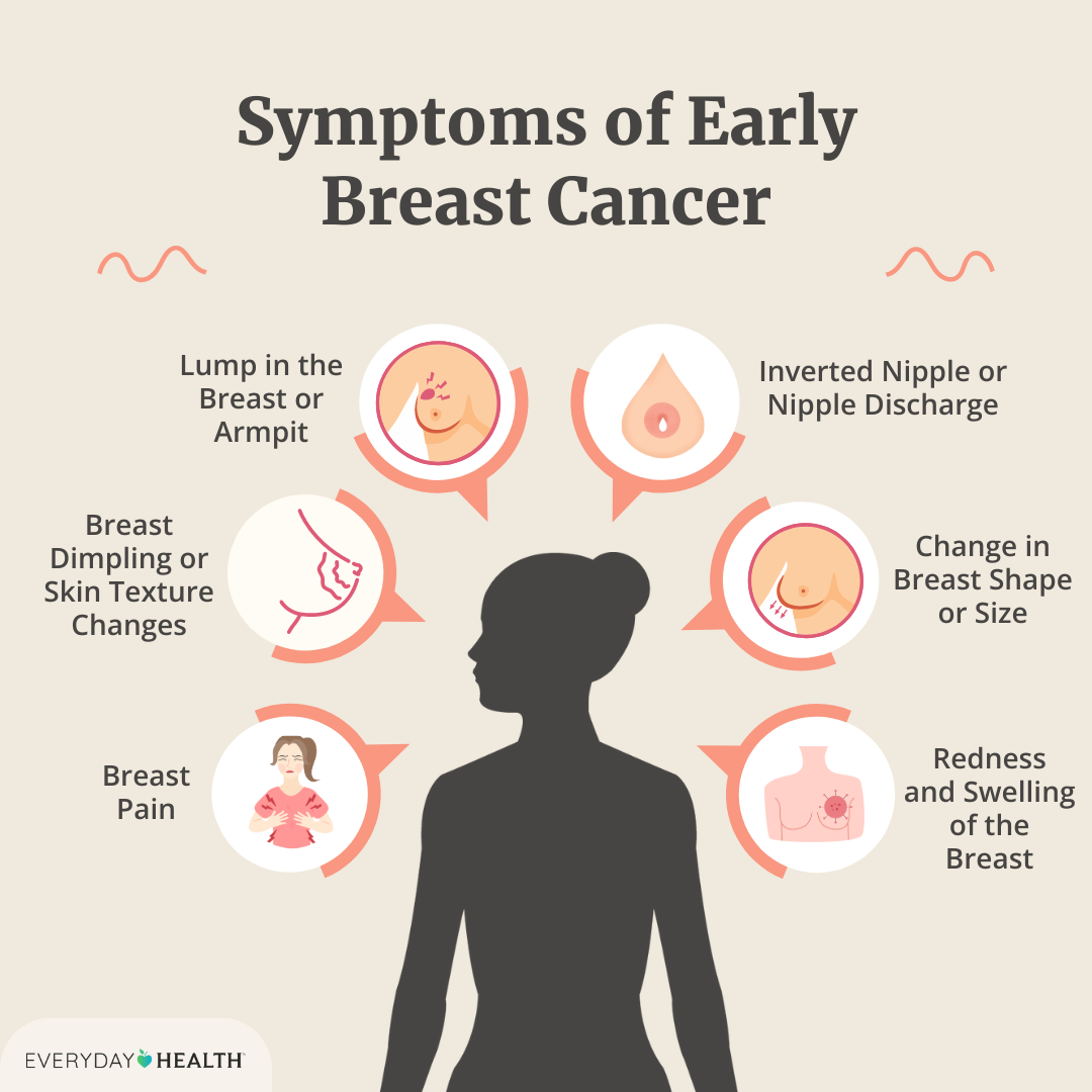 Illustrative graphic titled Symptoms of Early Breast Cancer shows lump in breast/armpit, breast dimpling, breast pain, redness or swelling, change in breast size and nipple discharge. Everyday Health logo