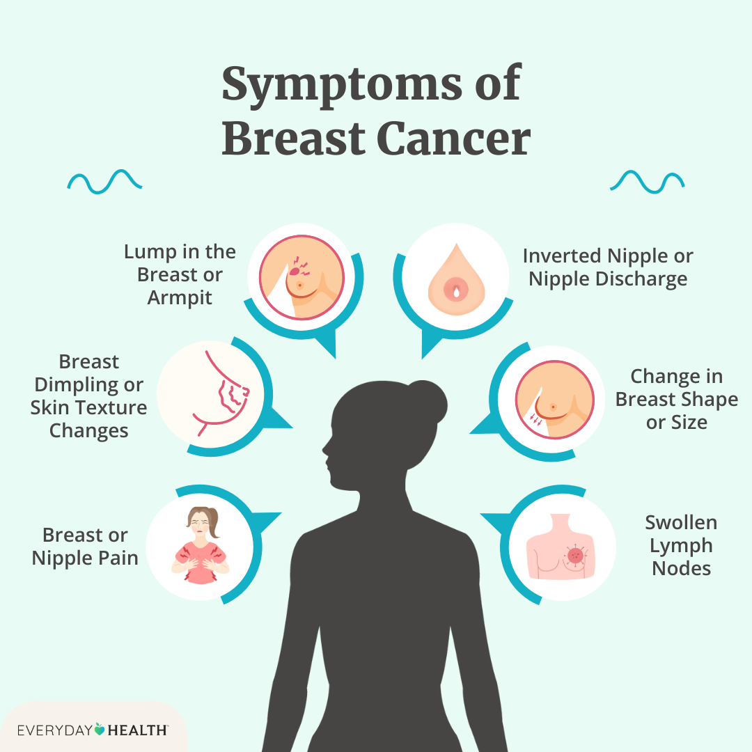 Illustrative graphic titled Symptoms of Breast Cancer Illustrative graphic titled Symptoms of Early Breast Cancer shows lump in breast/armpit, breast dimpling, breast pain, change in breast size and nipple discharge. Everyday Health logo
