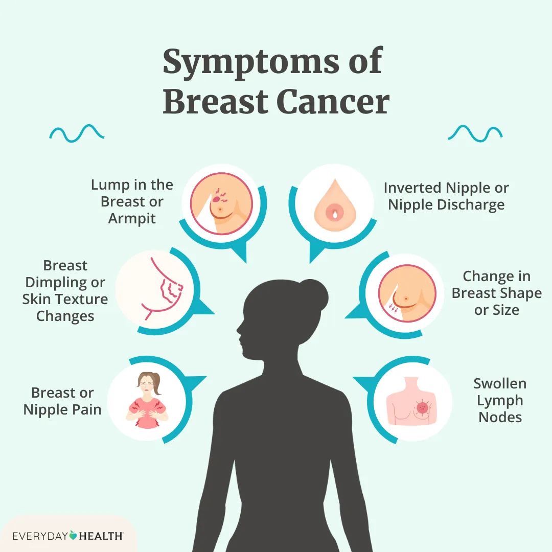 Illustrative graphic titled Symptoms of Breast Cancer Illustrative graphic titled Symptoms of Early Breast Cancer shows lump in breast/armpit, breast dimpling, breast pain, change in breast size and nipple discharge. Everyday Health logo