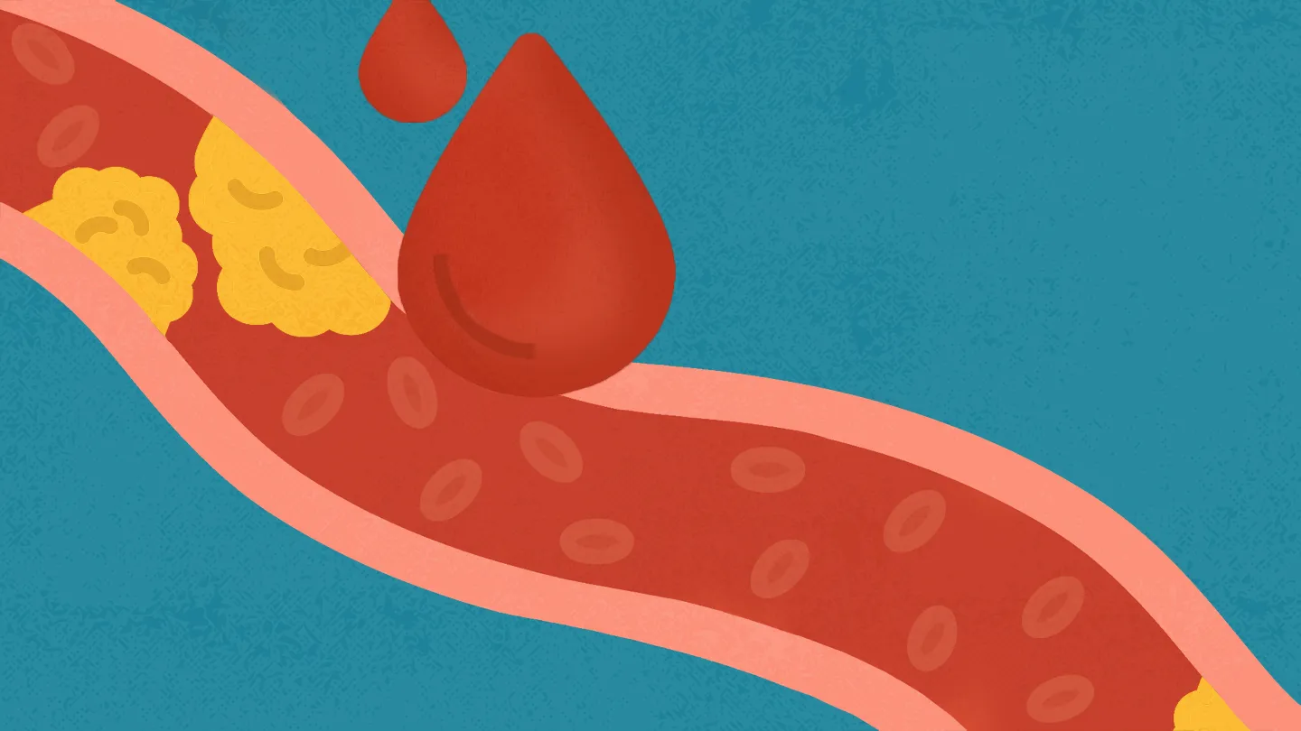 cholesterol blood stream fat