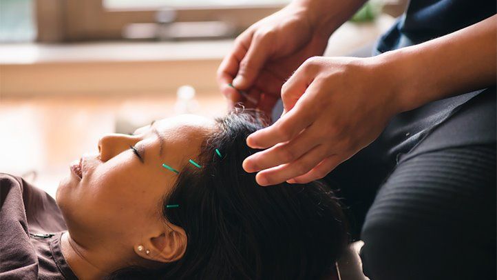 a person with headaches related to gallbladder problems getting acupuncture