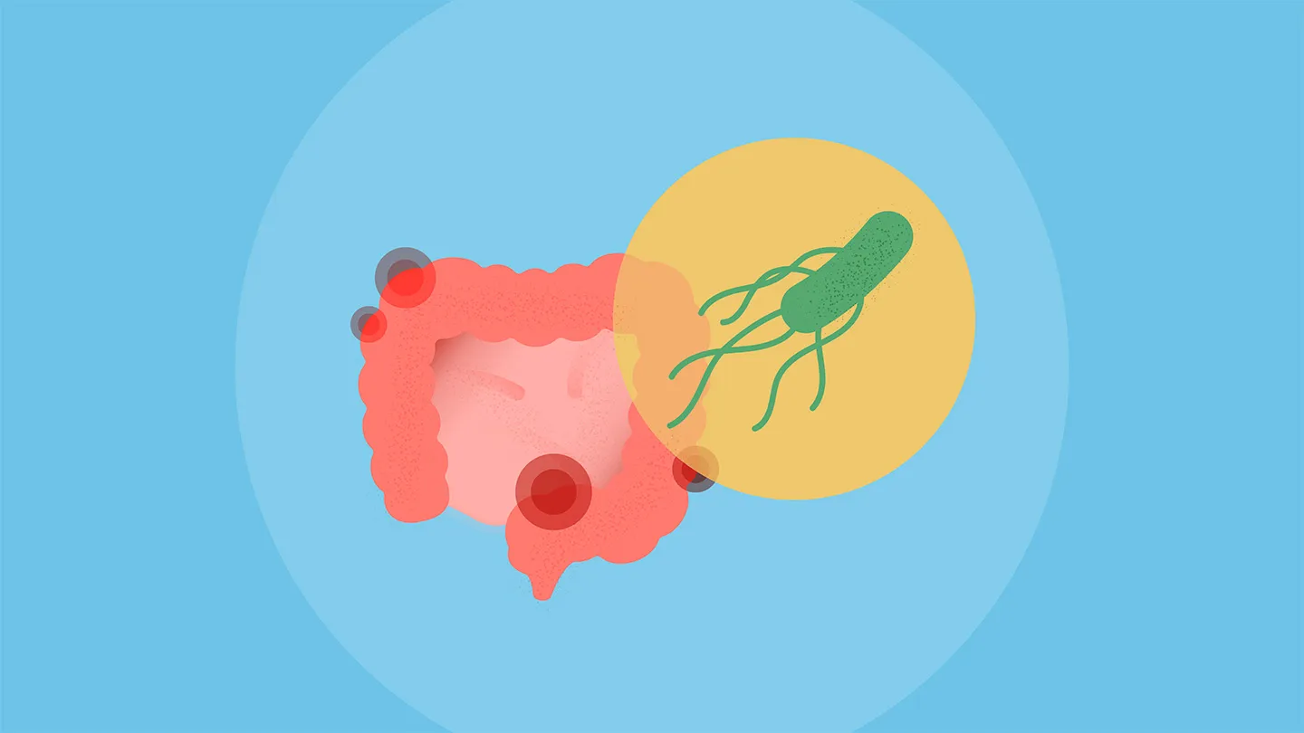 digestive tract colon marked with pink and red pain spots with a circle showing the e coli bacteria on yellow