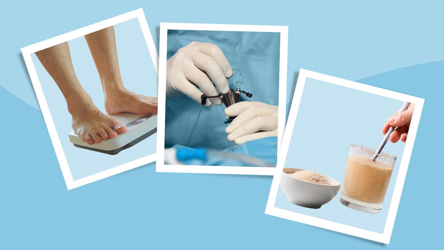 weight loss, Laparoscopic hernia repair, avoid constipation