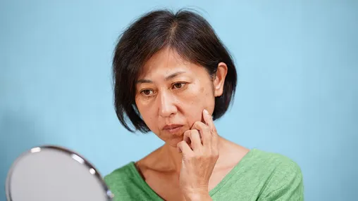 Melanoma or Age Spots? How to Tell the Difference