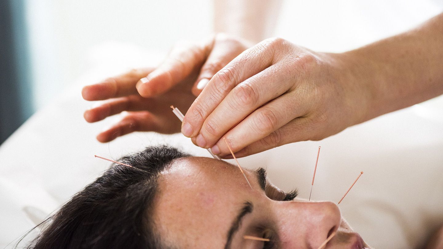 Natural-insomnia-aids-Acupuncture