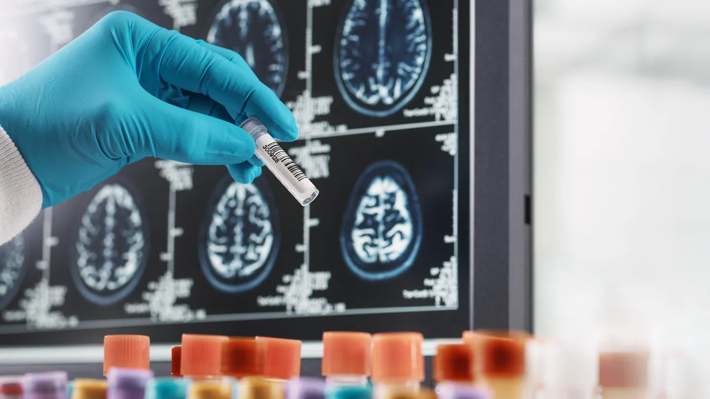 MS research