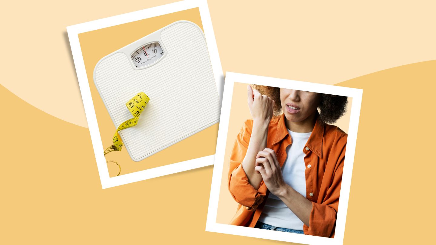 collage of scale and woman scratching her wrist