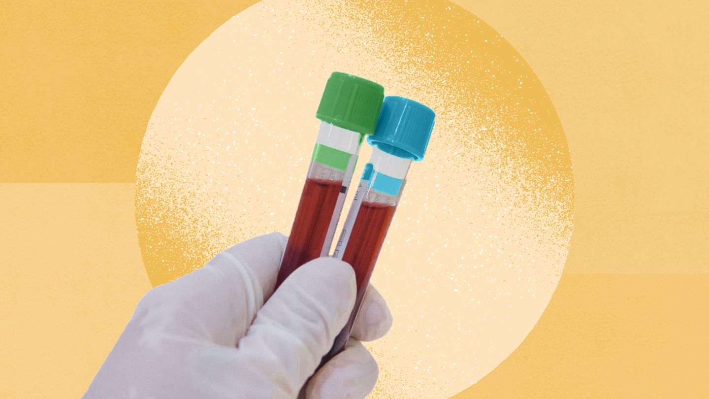 two blood test tubes PSA tests