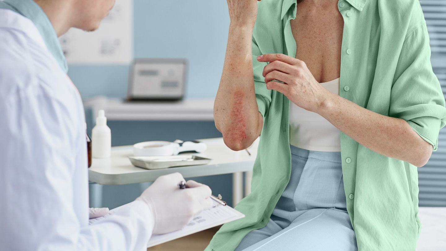 mature woman showing dermatologist her psoriasis rash on her arm