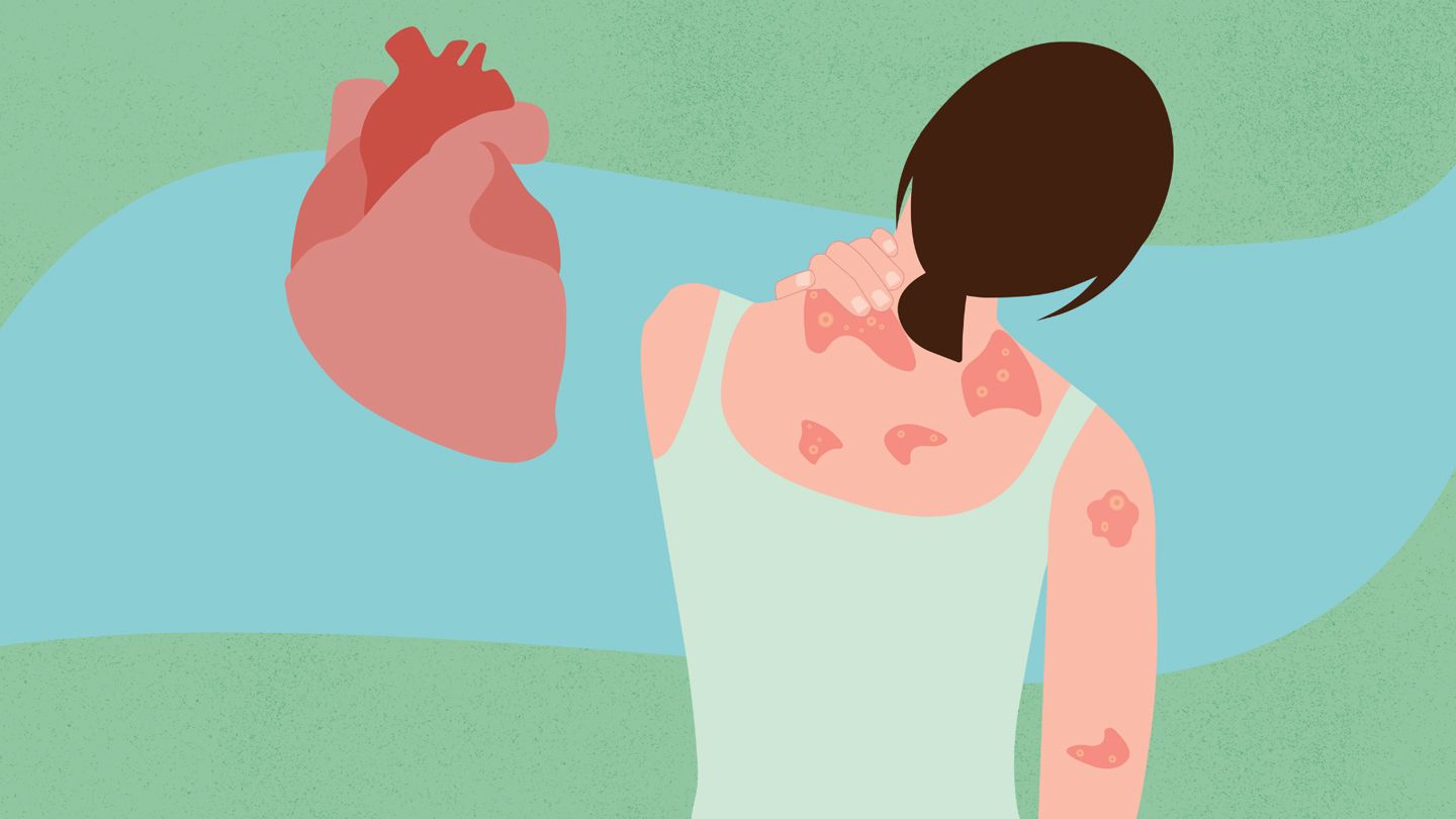 heart and rear view of woman with psoriasis illustrations