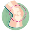 Psoriatic Arthritis