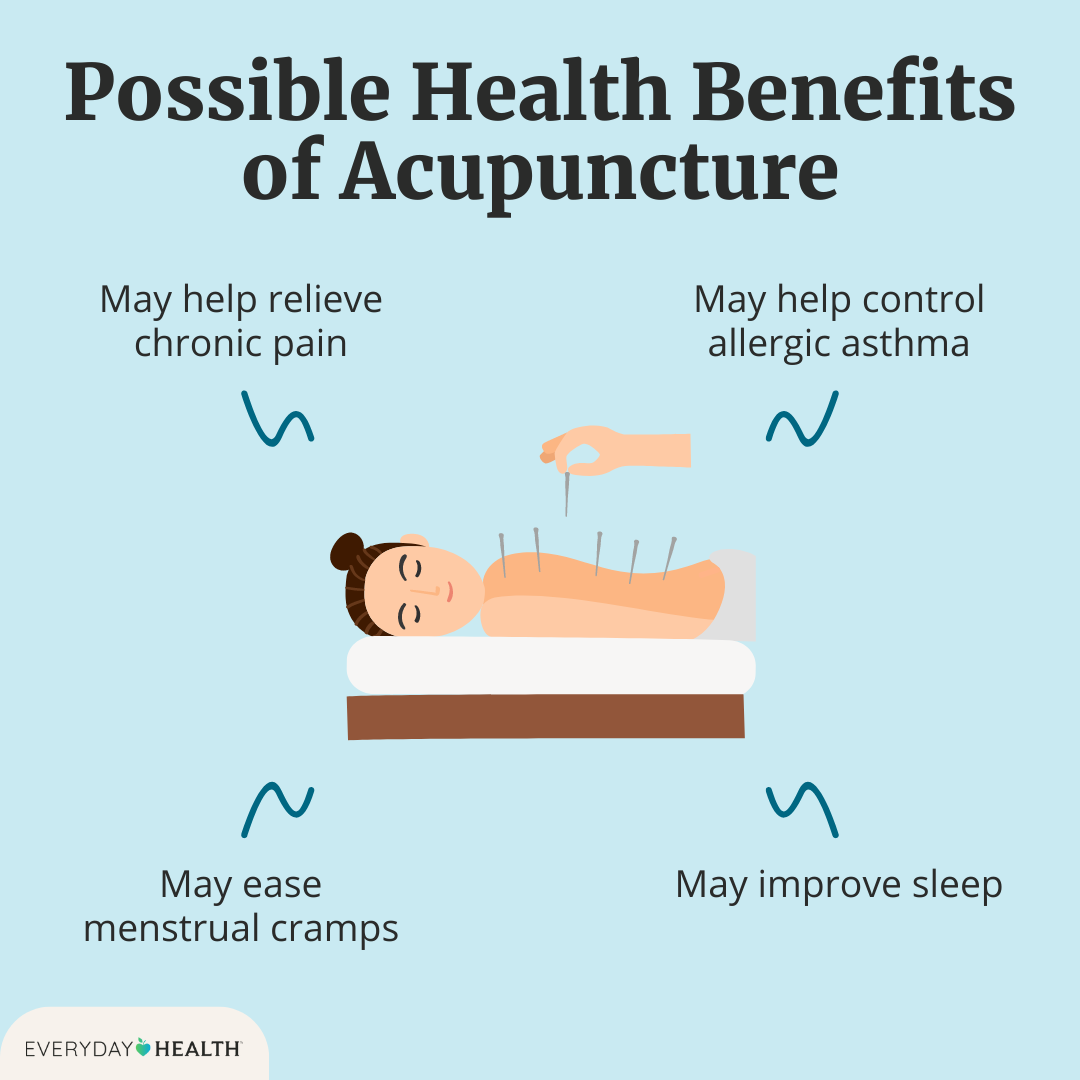 Illustrative graphic titled Potential health Benefits of Acupuncture shows may help relieve chronic pain, may help control allergic asthma, may ease menstrual cramps and may improve sleep. Everyday Health logo.