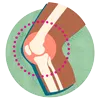 Rheumatoid Arthritis