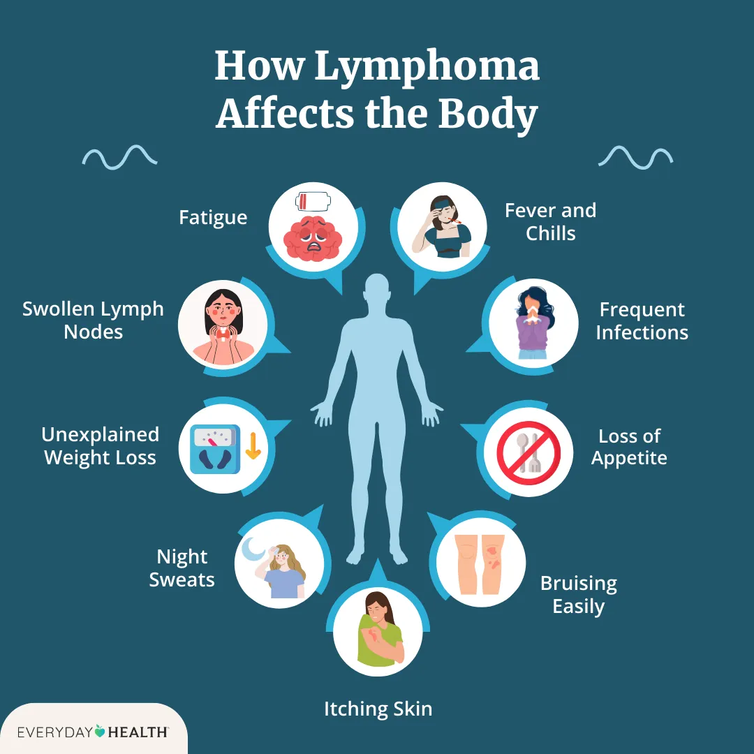 Graphic titled How Lymphoma Affects the Body shows symptoms including fatigue, swollen lymph nodes, weight loss, night sweats, itching skin, bruising easily, loss of appetite, frequent infections and fever/ chills. Everyday Health logo at bottom