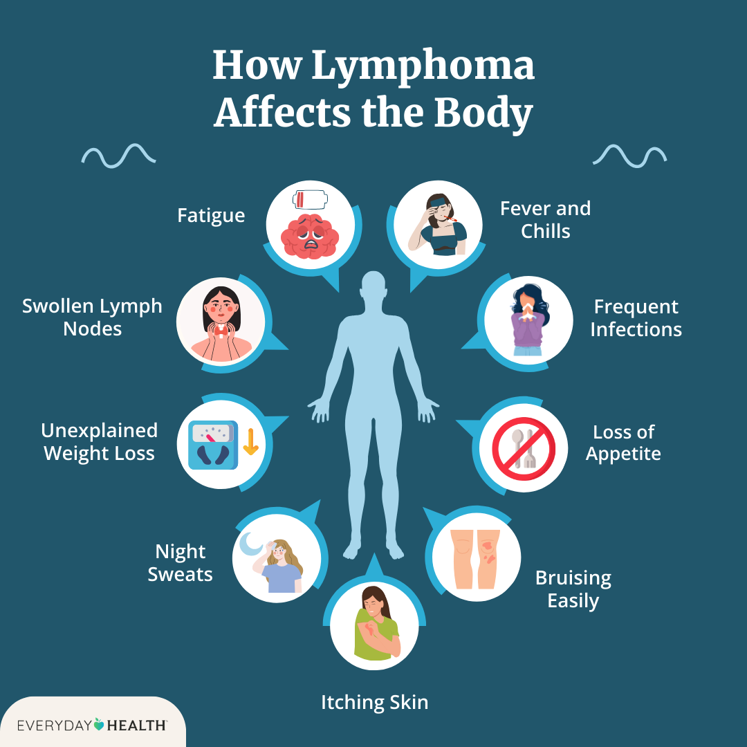 Graphic titled How Lymphoma Affects the Body shows symptoms including fatigue, swollen lymph nodes, weight loss, night sweats, itching skin, bruising easily, loss of appetite, frequent infections and fever/ chills. Everyday Health logo at bottom