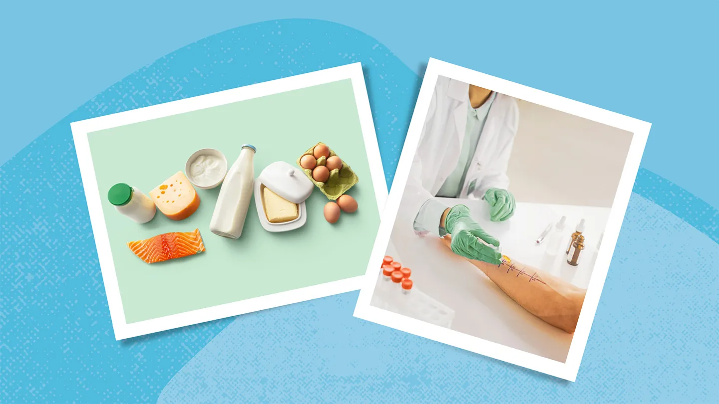eggs fish dairy products doctor allergy skin testing