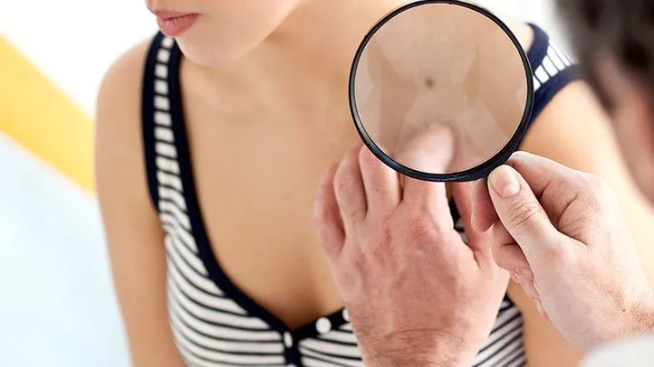 skin cancer symptoms