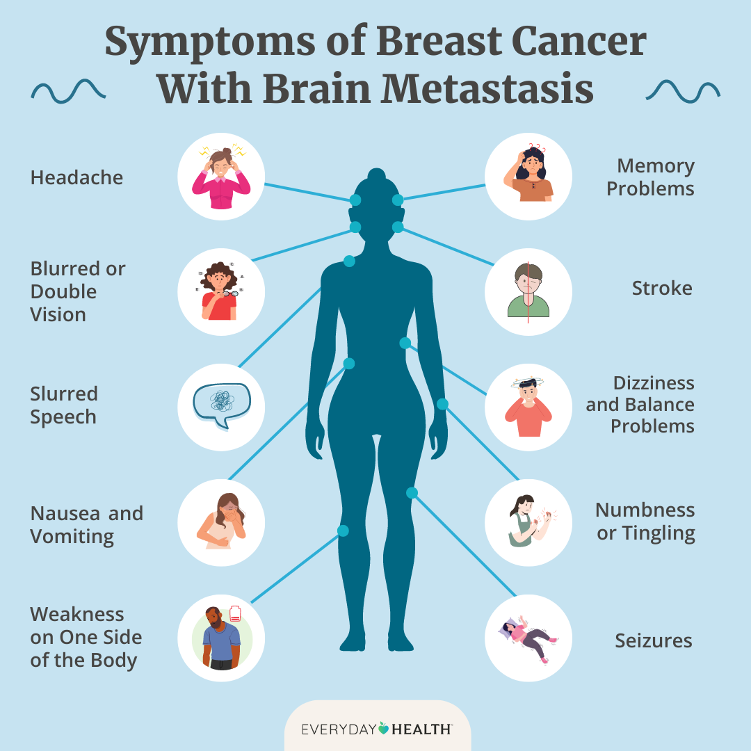 Title: Symptoms of Breast Cancer With Brain Metastasis. Headache, memory problems, blurred or double vision, stroke, slurred speech, dizzness and balance problems, nausea and vomiting, numbness or tingling, weakness on one side of body, seizures.
