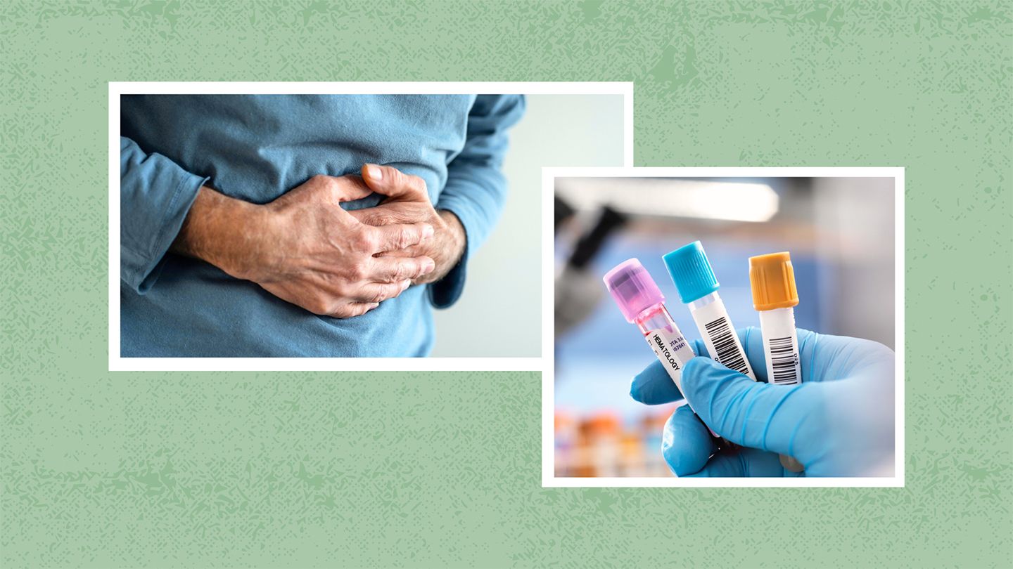 abdominal pain and anemia symptoms
