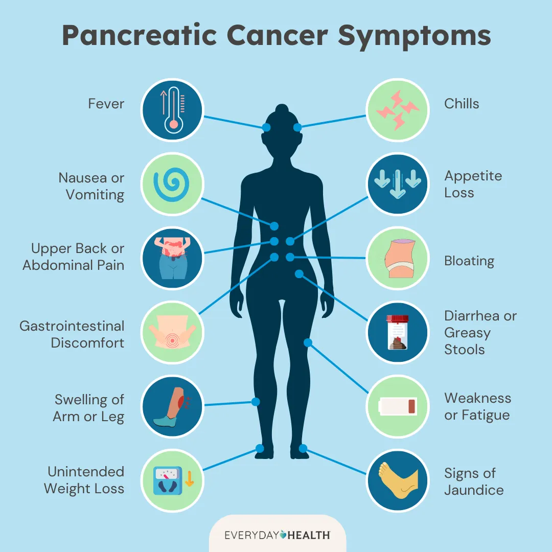 Illustrative graphic titled Pancreatic Cancer Symptoms shows Fever, Chills, Nausea or Vomiting, Appetite Loss, Upper Back or Abdominal Pain, Bloating, Gastrointestinal Discomfort, Diarrhea or Greasy Stools,  Swelling of Arm or Leg, Weakness or Fatigue..